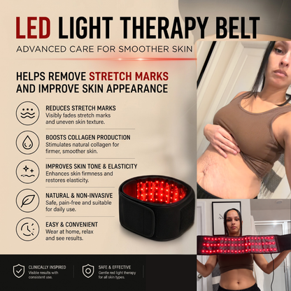 Red light belt - Stretch marks visibly reduced in 9 weeks